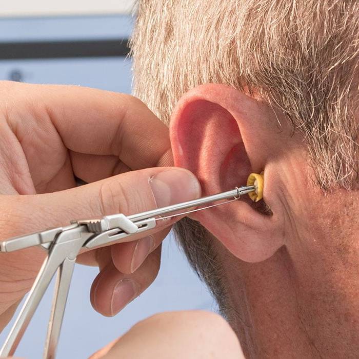 Lyric Hearing Aid Being Fitted By The Hearing Clinic UK